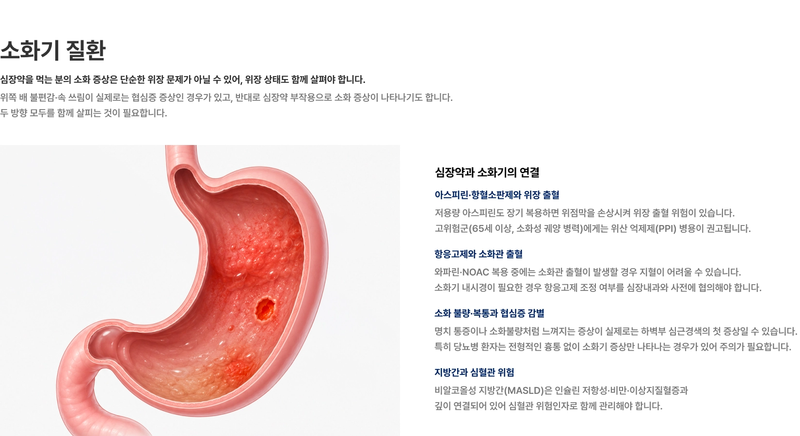 [소화기 질환] 심장약을 먹는 분의 소화 증상은 단순한 위장 문제가 아닐 수 있어 위장 상태도 함께 살펴야 합니다 아스피린·항혈소판제와 위장 출혈