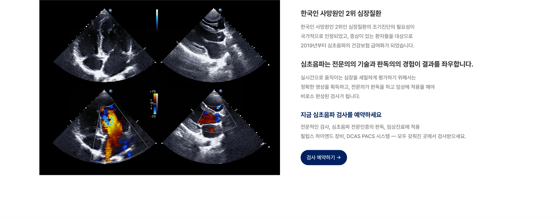 [한국인 사망원인 2위 심장질환] 한국인 사망원인 2위인 심장질환의 조기진단의 필요성이 국가적으로 인정되었고, 증상이 있는 환자들을 대상으로 2019년부터 심초음파의 건강보험 급여화가 되었습니다 [심초음파는 검사자의 기술과 판독의의 경험이 결과를 좌우합니다]