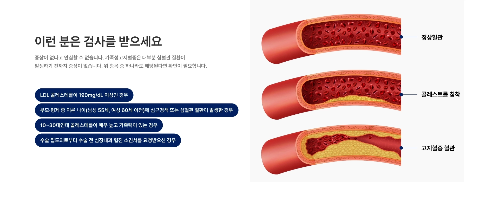 [이런 분은 검사를 받으세요] 증상이 없다고 안심할 수 없습니다 LDL 콜레스테롤이 190mg/dL 이상인 경우 부모·형제 중 남성 55세 여성 60세 이전에 심근경색 심혈관 질환이 발생한 경우
